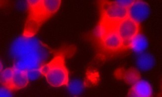 Врачи научились искусственно выращивать клетки, которые умеют бороться с раком