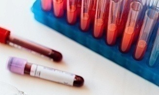 В Беларуси опробуют уникальный онкотест: он по крови определяет более 60 видов опухолей